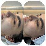 کلینیک لیزر  کندلاوزیبایی پوست ومو آیشیل