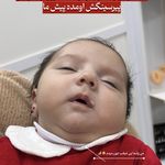 دلسا پیرسینگ