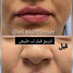 مطب زیبایی دکتر ملکی