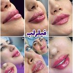 کلینیک لیزر و زیبایی دایان