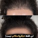 اولین مرکز اسکراپ و میکرواسکالپ در مشهد