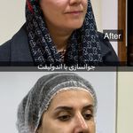 کلینیک آیلی