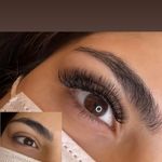 اپیلاسیون مارینو تخصصی