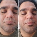 مرکز تخصصی لیزر