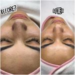خدمات تخصصی فیشیال مهسا پورنجف