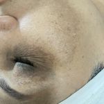 سالن تخصصی پاکسازی پوست هما