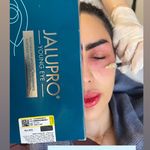 مرکز لیزر ،پوست و زیبایی کندی بیوتی