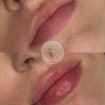 کلینیک پوست مو زیبایی  آیسان امیدی(وتنم)