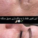 خدمات فیشال ،پاکسازی ندادمیرچی کلینیکBKD