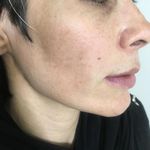 کلینیک زیبایی الماس کاملا اقساطی