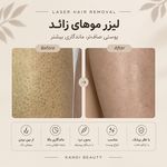 مرکز لیزر ،پوست و زیبایی کندی بیوتی