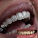 مركز دندانپزشکی دکترفرنوش عیوضی