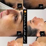 کلینیک لیزر و زیبایی ققنوس