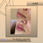 مطب پوست مو زیبایی فردوس شرق