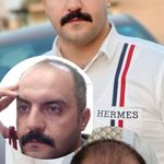 کلینیک زیبایی و کاشت مو تخصصی دستانی