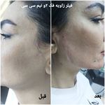 کلینیک زیبایی و لیزر مو گندم شرق تهران