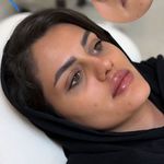 کلینیک زیبایی نگین دلارام