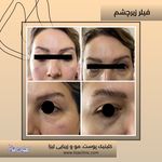 مطب پوست مو زیبایی فردوس شرق
