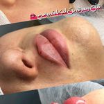 کلینیک زیبایی و لیزر هیرا