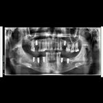 مطب دندانپزشکی دکتر پیمان رستمیان