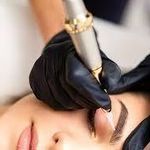 ریموو آرتیست