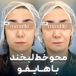 کلینیک زیبایی مانشید