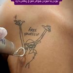 مطب پوست مو لیزر و زیبایی آریاناز