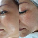 کلینیک تخصصی پوست ملینا