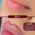 مطب زیبایی سیسو