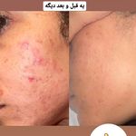 فیشال تخصصی سوزان