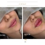 مرکز لیزر و کلینیک زیبایی دکتر با حجب