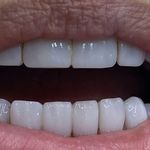 دندانپزشکی دکتر آزاده خلجیان