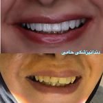 دندانپزشکی حامی (طرف قراردادبیمه نیستیم)