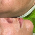 آموزش و خدمات پوست خواهران جعفرزاده