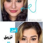 کلینیک تخصصی پوست و زیبایی ملینا