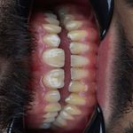 خدمات تخصصی ایمپلنت و لمینت دن