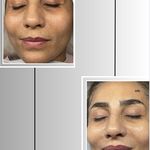 کلینیک فیشیال و پاکسازی پوست صبا