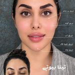 Tina Beauty Center|مرکز زیبایی تینابیوتی