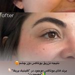 مرکز لیزر و کلینیک زیبایی پریفا