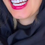 دندانپزشکی زیبایی دکتر پریسا دهقانی