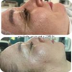 جوانسازی و فیشال پوست خدارحمی
