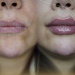 کلینیک زیبایی الماس کاملا اقساطی