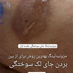خدمات تخصصی آرایش دائم وریموواستادحمیدی