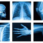 رادیولوژی مهر