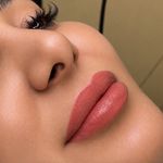 ریموو شیدینگ میکروبلیدینگ