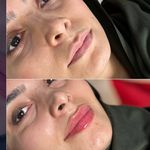 مجموعه زیبایی آتی‌ماه