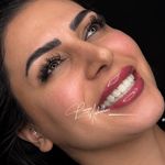 دکتر پریا اقاخانی،وام‌۱۵۰میلیونی دننالیت
