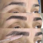 میکروبلیدینگ ملیکادولتی