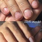 خدمات ناخن کاشت،ترمیم،لمینت شادی رسولپور