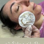 فیشیال و پاکسازی پوست مرجان ⭐